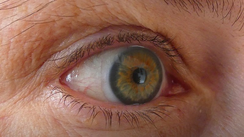 Closeup of the eye, showing the light tint on the rim of a corrective contact lense, tags: eye - CC BY-SA